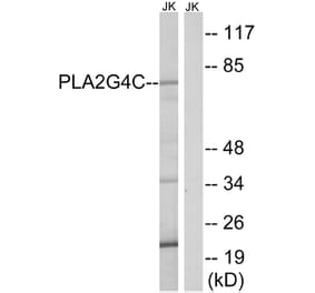 Western Blot - Anti-PLA2G4C Antibody (C15308) - Antibodies.com