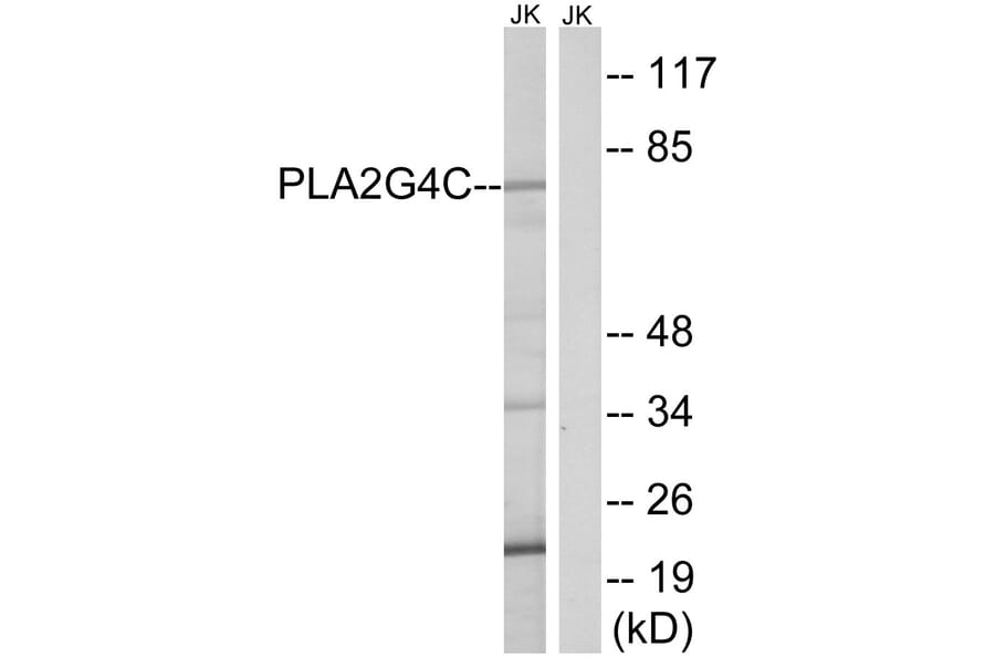 Western Blot - Anti-PLA2G4C Antibody (C15308) - Antibodies.com