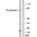Western Blot - Anti-PLA2G4C Antibody (C15308) - Antibodies.com