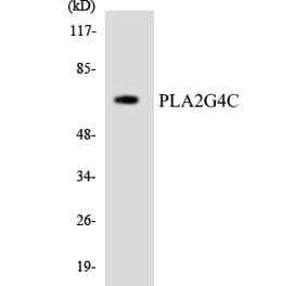 Western Blot - Anti-PLA2G4C Antibody (R12-3333) - Antibodies.com