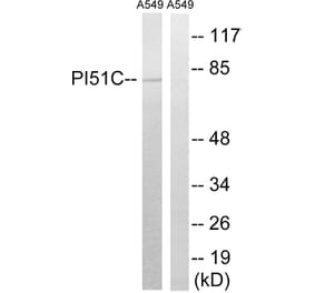 Western Blot - Anti-PIP5K1C Antibody (C17692) - Antibodies.com