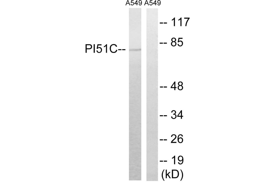 Western Blot - Anti-PIP5K1C Antibody (C17692) - Antibodies.com