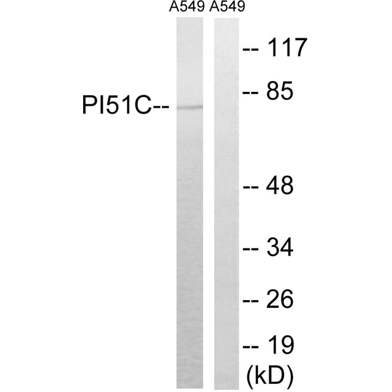 Western Blot - Anti-PIP5K1C Antibody (C17692) - Antibodies.com