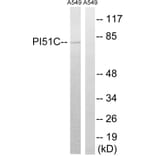 Western Blot - Anti-PIP5K1C Antibody (C17692) - Antibodies.com