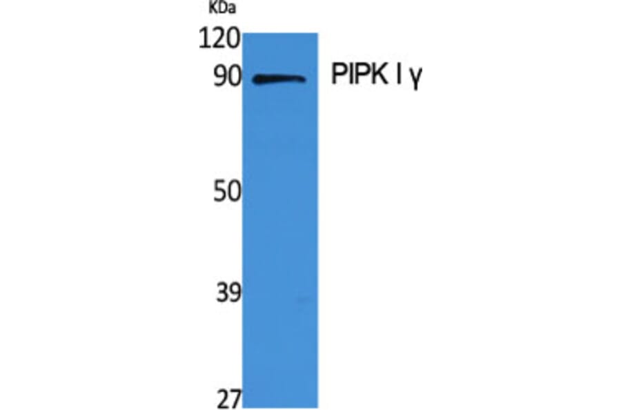 Western Blot - Anti-PIP5K1C Antibody (C17692) - Antibodies.com
