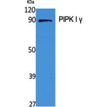 Western Blot - Anti-PIP5K1C Antibody (C17692) - Antibodies.com