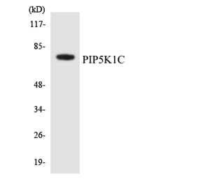 Western Blot - Anti-PIP5K1C Antibody (R12-3328) - Antibodies.com