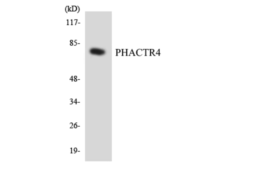 Western Blot - Anti-PHACTR4 Antibody (R12-3322) - Antibodies.com