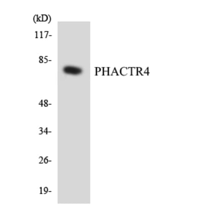 Western Blot - Anti-PHACTR4 Antibody (R12-3322) - Antibodies.com