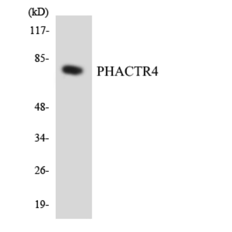 Western Blot - Anti-PHACTR4 Antibody (R12-3322) - Antibodies.com