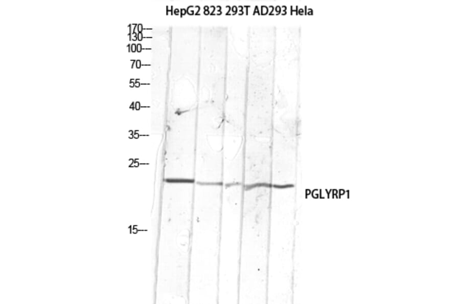 Western Blot - Anti-PGLYRP1 Antibody (C30977) - Antibodies.com
