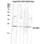 Western Blot - Anti-PGLYRP1 Antibody (C30977) - Antibodies.com