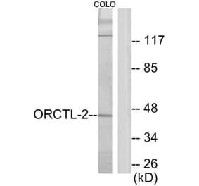 Western Blot - Anti-ORCTL-2 Antibody (C11478) - Antibodies.com