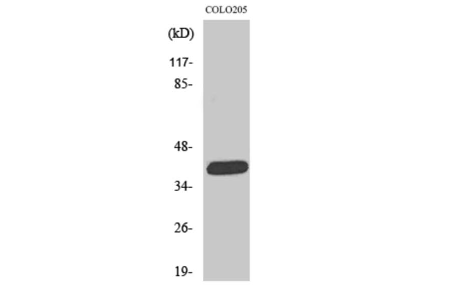 Western Blot - Anti-ORCTL-2 Antibody (C11478) - Antibodies.com