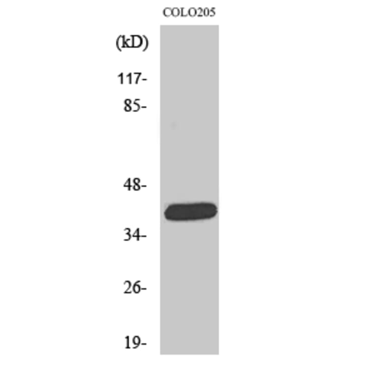 Western Blot - Anti-ORCTL-2 Antibody (C11478) - Antibodies.com