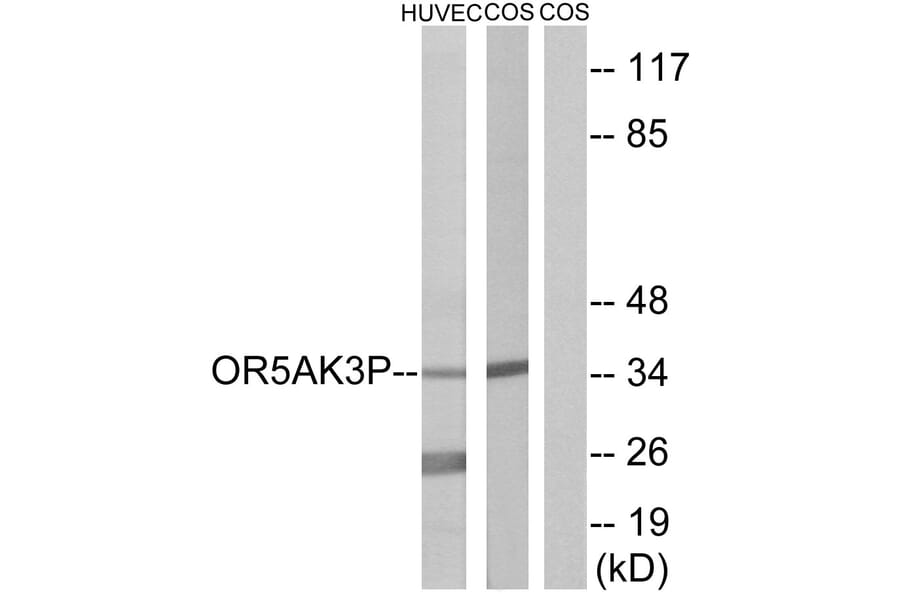 Western Blot - Anti-OR5AK3P Antibody (G471) - Antibodies.com