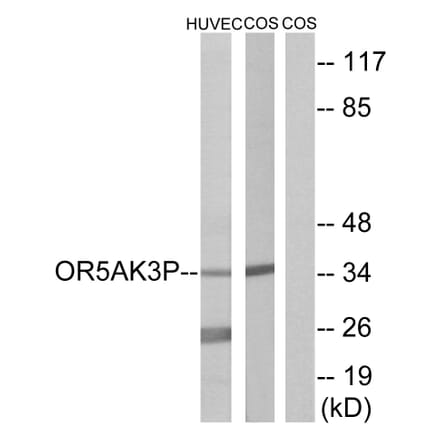 Western Blot - Anti-OR5AK3P Antibody (G471) - Antibodies.com