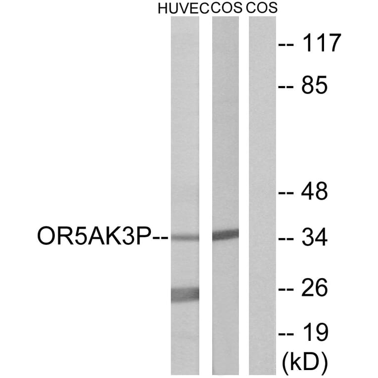 Western Blot - Anti-OR5AK3P Antibody (G471) - Antibodies.com