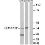 Western Blot - Anti-OR5AK3P Antibody (G471) - Antibodies.com