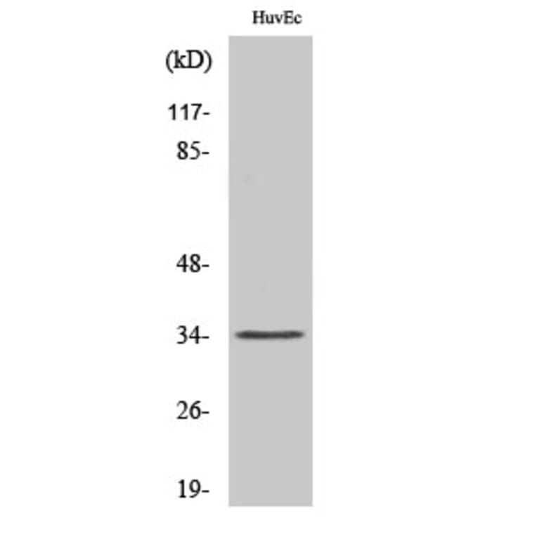 Western Blot - Anti-OR5AK3P Antibody (G471) - Antibodies.com