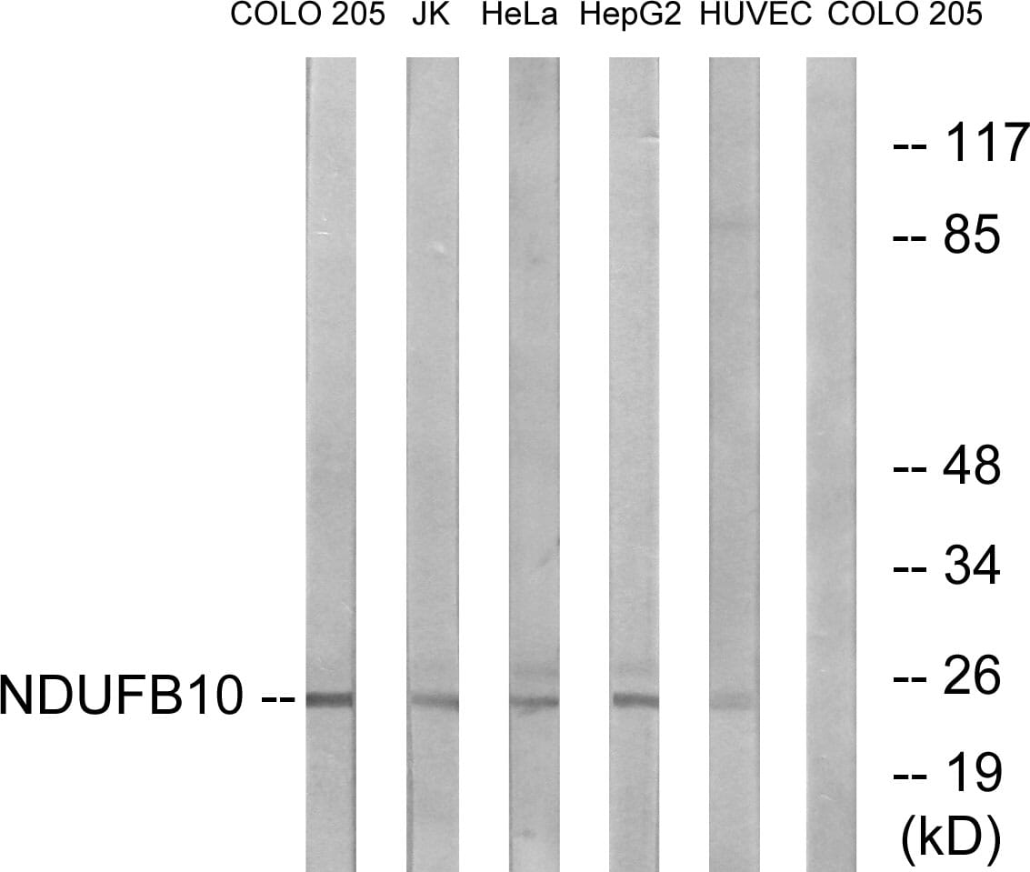 Western blot analysis of lysates from COLO, Jurkat, HeLa, HepG and HUVEC cells using Anti-NDUFB10 Antibody. The right hand lane represents a negative control, where the antibody is blocked by the immunising peptide.