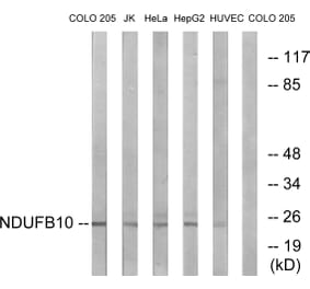 Western Blot - Anti-NDUFB10 Antibody (C16829) - Antibodies.com