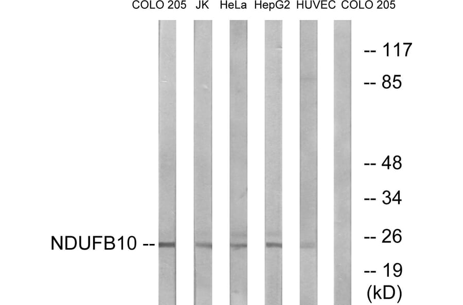 Western Blot - Anti-NDUFB10 Antibody (C16829) - Antibodies.com