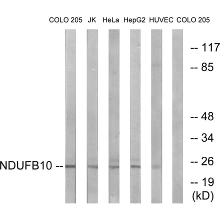 Western Blot - Anti-NDUFB10 Antibody (C16829) - Antibodies.com