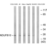 Western Blot - Anti-NDUFB10 Antibody (C16829) - Antibodies.com