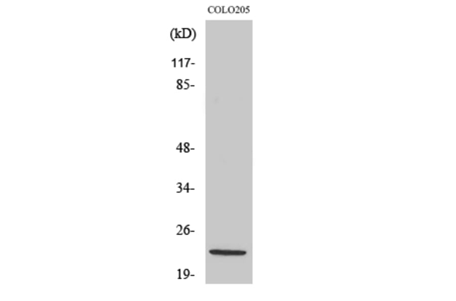 Western Blot - Anti-NDUFB10 Antibody (C16829) - Antibodies.com