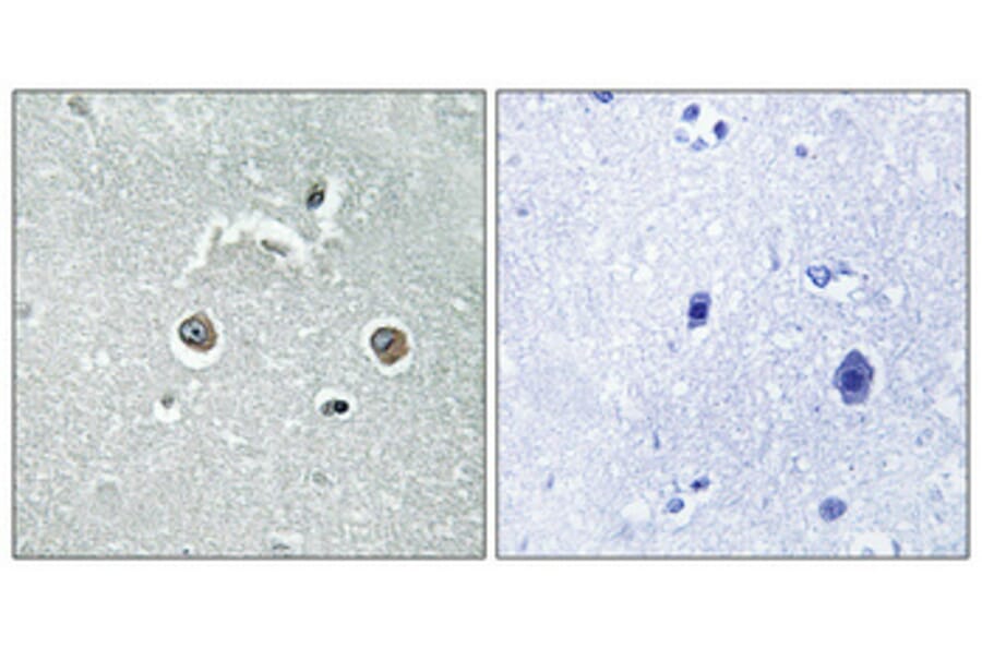 Immunohistochemistry - Anti-NDUFB10 Antibody (C16829) - Antibodies.com