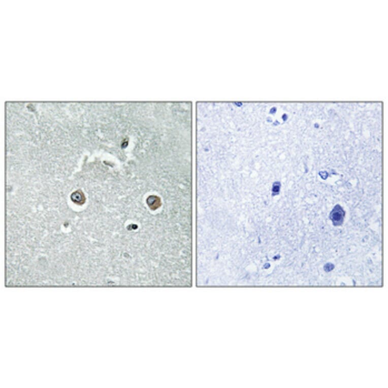 Immunohistochemistry - Anti-NDUFB10 Antibody (C16829) - Antibodies.com