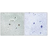 Immunohistochemistry - Anti-NDUFB10 Antibody (C16829) - Antibodies.com