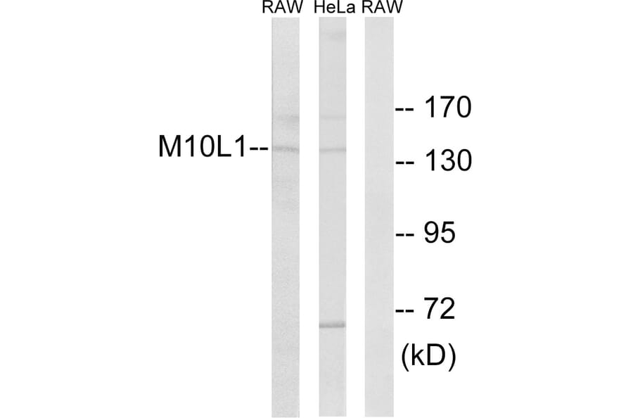 Western Blot - Anti-MOV10L1 Antibody (C18087) - Antibodies.com