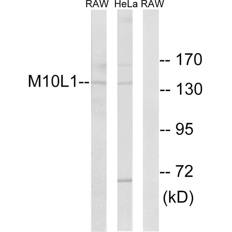 Western Blot - Anti-MOV10L1 Antibody (C18087) - Antibodies.com