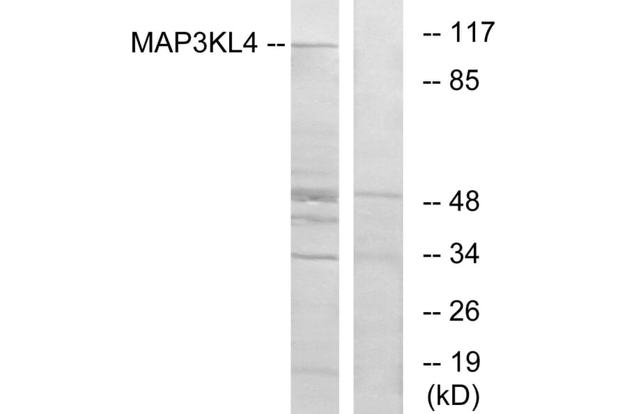 Western Blot - Anti-MAP3KL4 Antibody (C11190) - Antibodies.com