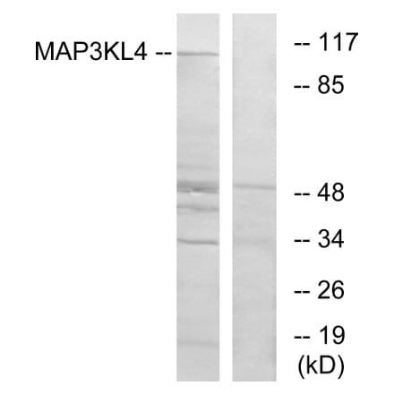 Western Blot - Anti-MAP3KL4 Antibody (C11190) - Antibodies.com