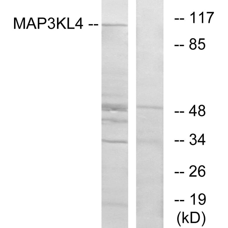 Western Blot - Anti-MAP3KL4 Antibody (C11190) - Antibodies.com