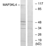 Western Blot - Anti-MAP3KL4 Antibody (C11190) - Antibodies.com