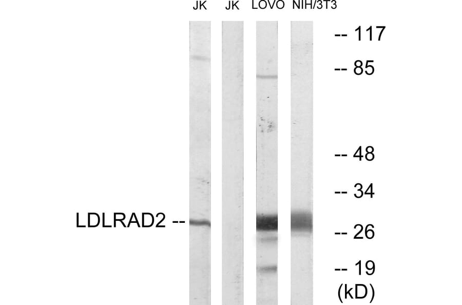 Western Blot - Anti-LDLRAD2 Antibody (C16504) - Antibodies.com