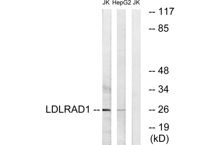 Western Blot - Anti-LDLRAD1 Antibody (C16503) - Antibodies.com