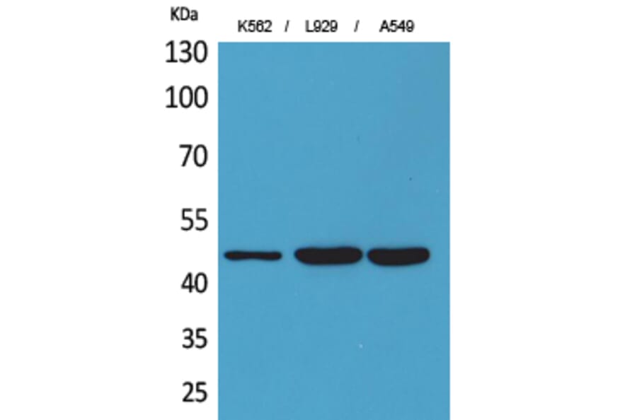 Western Blot - Anti-KIR3DL3 Antibody (C30485) - Antibodies.com