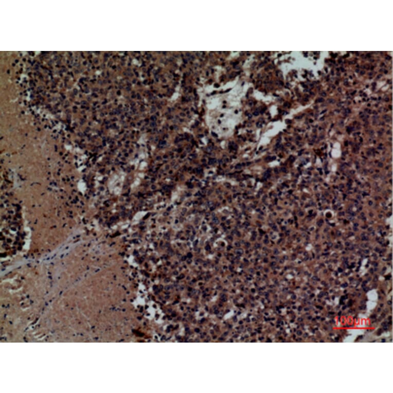 Immunohistochemistry - Anti-KIR3DL3 Antibody (C30485) - Antibodies.com