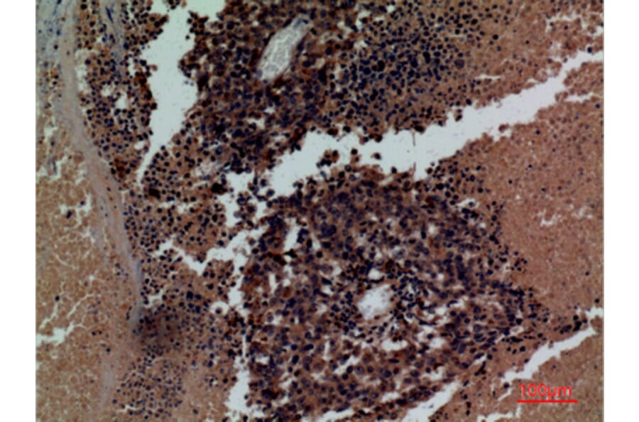 Immunohistochemistry - Anti-KIR3DL3 Antibody (C30485) - Antibodies.com