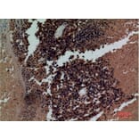 Immunohistochemistry - Anti-KIR3DL3 Antibody (C30485) - Antibodies.com