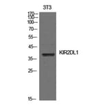 Western Blot - Anti-KIR2DL1 Antibody (C30474) - Antibodies.com