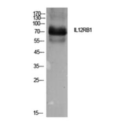 Western Blot - Anti-IL12RB1 Antibody (C30455) - Antibodies.com