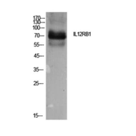 Western Blot - Anti-IL12RB1 Antibody (C30455) - Antibodies.com