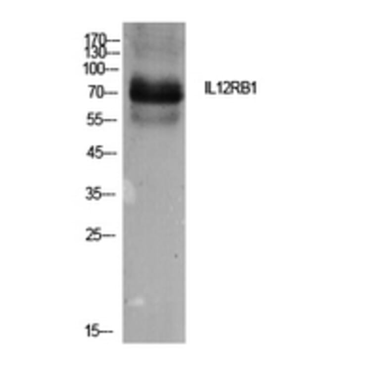 Western Blot - Anti-IL12RB1 Antibody (C30455) - Antibodies.com