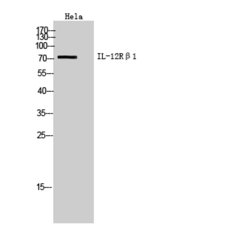 Western Blot - Anti-IL12RB1 Antibody (C30455) - Antibodies.com